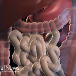 Digestion